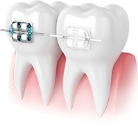 balçova diş hekimi