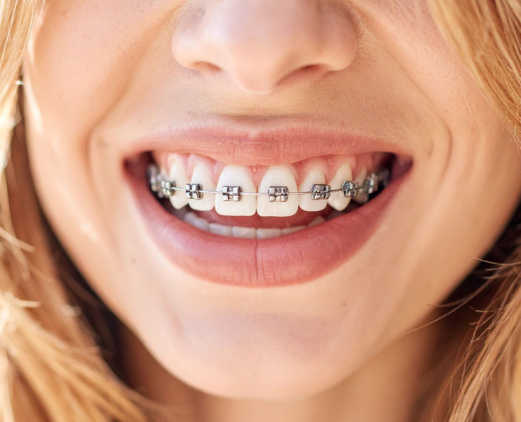 balcova ortodonti tedavisi