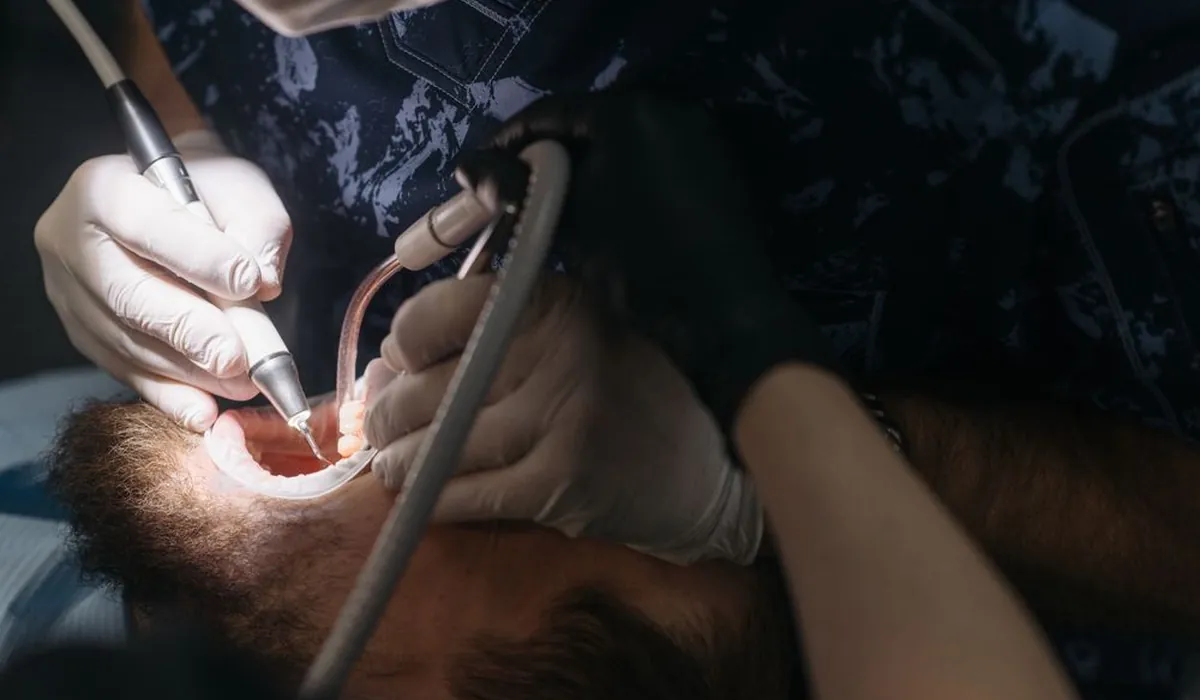 Ultrasonik alet ile diş taşı temizliği yapılan yakın çekim